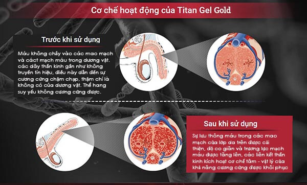 XTS10C Gel Titan Gel Gold kích thích làm tăng kích cỡ dương vật